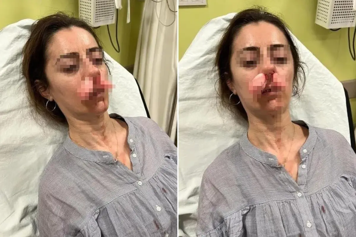 Kocasının sevgilisi zannedip öldüresiye darp etmişti! Arabanın kapısı silah sayıldı Kocasının sevgilisi zannedip öldüresiye darp etmişti! Arabanın kapısı silah sayıldı