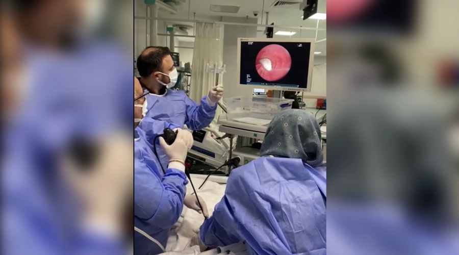 Hastanın akciğerine kaçan sarımsak operasyonla çıkarıldı