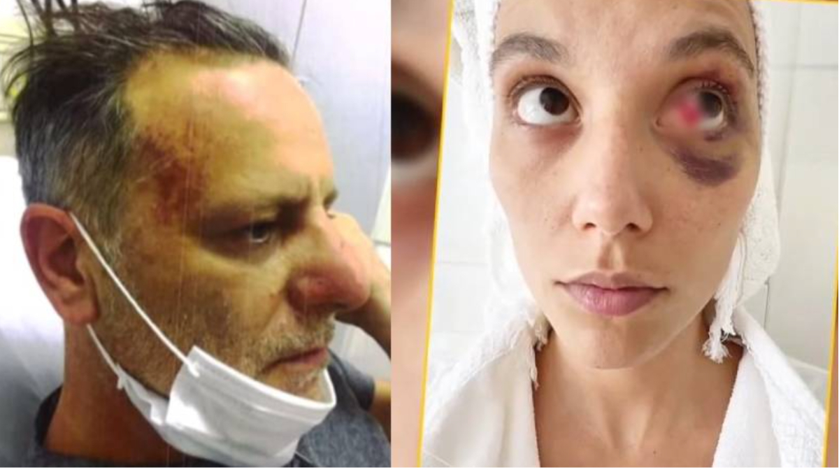 Ozan Güven: Deniz’den özür dilemeyeceğim çünkü hiçbir şey yapmadım