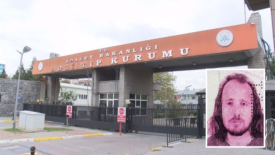 Saç Ekimi ve Diş Tedavisi İçin Türkiye’ye Gelen Turist…